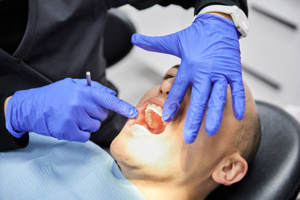 Best Emergency Tooth Extraction in Clearwater, KS