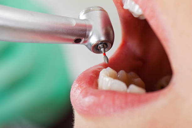 Best Emergency Broken Tooth Repair in Clearwater, KS